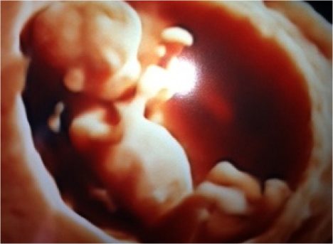 Fetus at sixteen weeks
