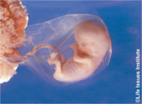 Fetus eight weeks after conception
